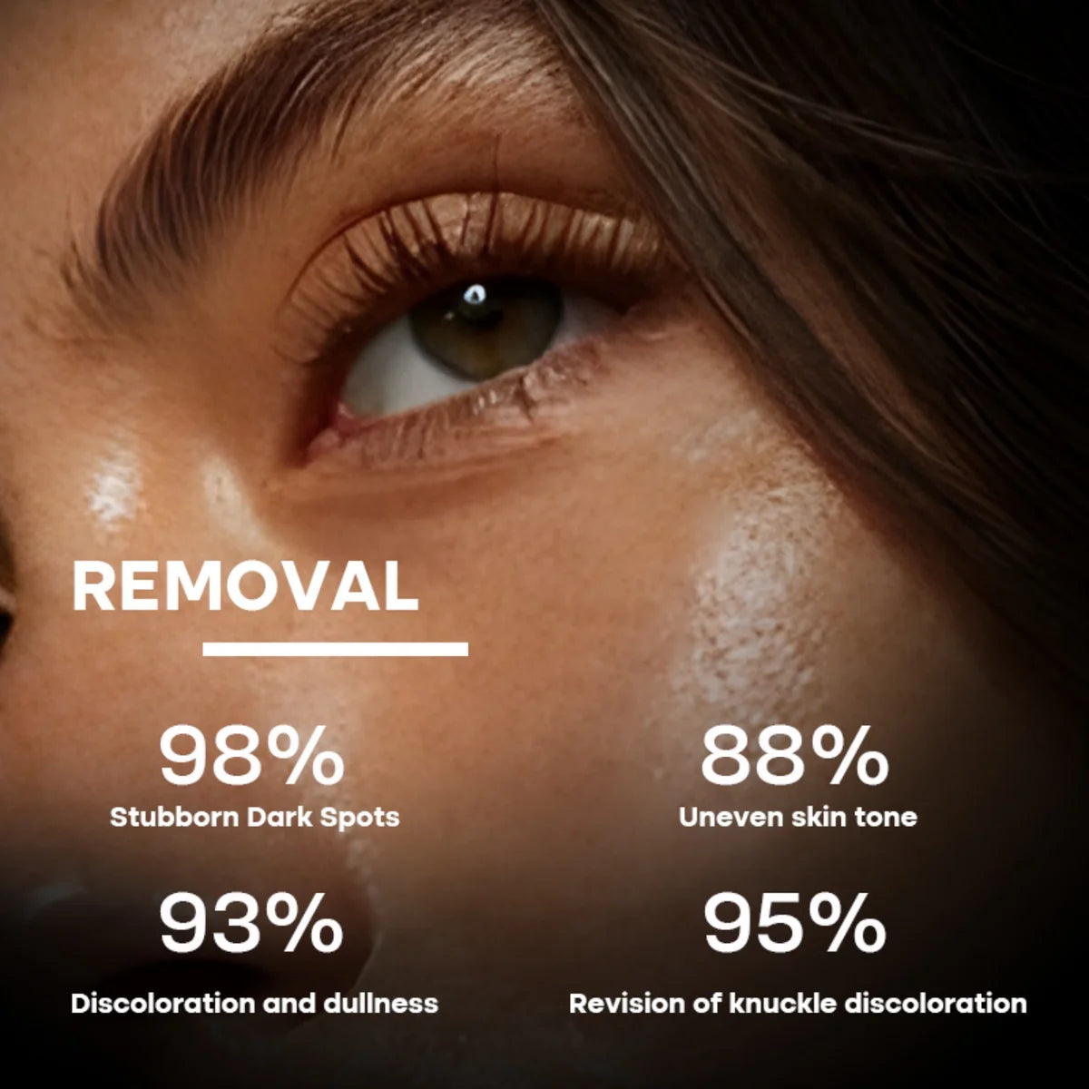 Supplier graphic about Anti-Spot Serum for dark spots and uneven skin tone