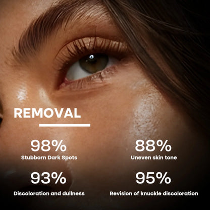 Supplier graphic about Anti-Spot Serum for dark spots and uneven skin tone