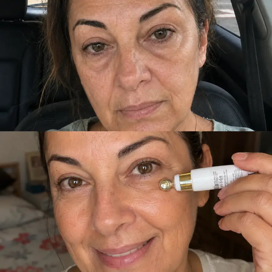Skin by Flora 4-in-1 Eye Cream customer before and after result