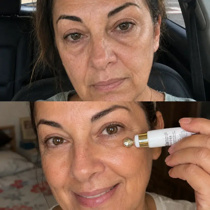 Skin by Flora 4-in-1 Eye Cream customer before and after result